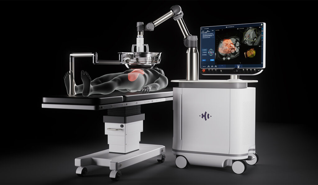 Histotripsy: Doctors Harness Soundwaves and Water to Treat Liver Tumors